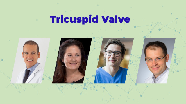 PCRonline's tweet photo. 🔴 Sit back, relax and get ready for a moment with @VRudolph_HDZ, @juliendreyfus1, @dralisonduncan & @PhilippLurz as they discuss about "#TRISCEND II: implications on current clinical practice" during this #PCRwebinar!
Join us here now 👉🏽https://t.co/DPHxJRYWcT #TTVR https://t.co/DVpH5ok6NW