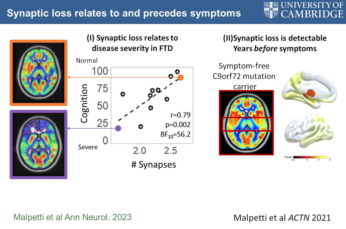CambridgeFTD's tweet image. Fantastic morning at the #DGN Kongress 2024 Berlin, discussing #SynapticHealth and synaptic biomarkers in blood, CSF, PET and pathology. Thanks to Markus Otto, Patrick Oeckl, Dietmar Thal @lorbarba and @M_Malpetti and the great audience @wbic_cam @DementiasUK