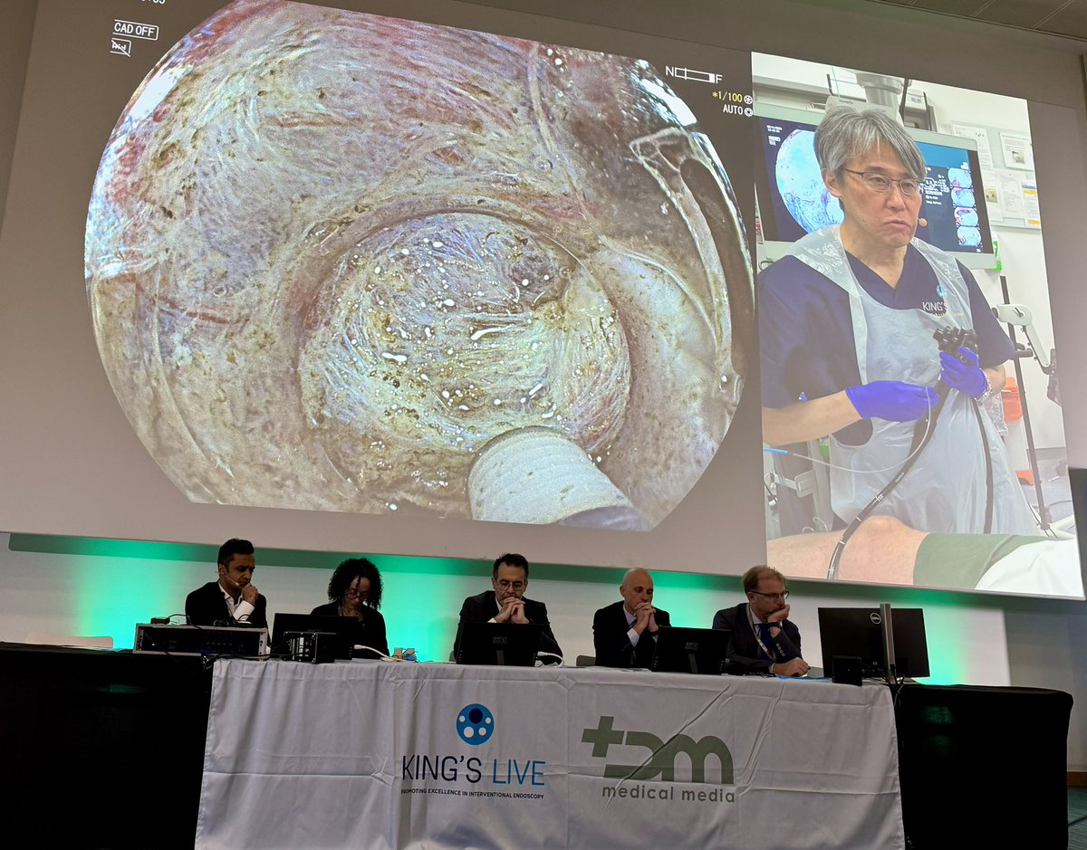Noor_Endo (@noor_endo) on Twitter photo Fantastic demonstration of caecal ESD by the master of ESDs - Prof Toyonaga sensei at <a href="/kingslivelondon/">King's Live</a>.
Learning points
1. Saline immersion helps
2. Adopt right technique for safer dissection
3. Be precise 🔪 and patient🧘♂️
Great moderation by <a href="/NorikoSuzuki3/">Dr Noriko Suzuki 💙</a> 👏👏👏 Fantastic demonstration of caecal ESD by the master of ESDs - Prof Toyonaga sensei at <a href="/kingslivelondon/">King's Live</a>.
Learning points
1. Saline immersion helps
2. Adopt right technique for safer dissection
3. Be precise 🔪 and patient🧘♂️
Great moderation by <a href="/NorikoSuzuki3/">Dr Noriko Suzuki 💙</a> 👏👏👏