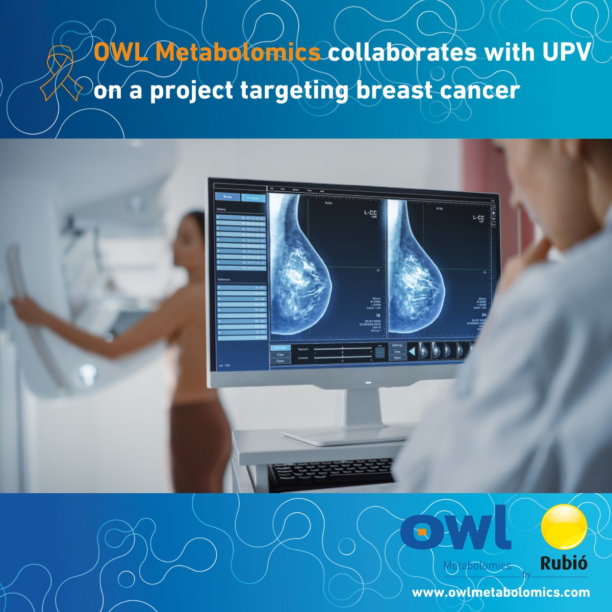 RubioOmics's tweet photo. 🔬 @OWLMetabolomics is proud to collaborate on a new project targeting #BreastCancer! 

Led by Erika Pineda at @UPV, the research uses nanotechnology to destroy tumor cells with precision. 

Together, we’re advancing cancer treatment.

#MarieCurie #CancerResearch #Nanomedicine https://t.co/M4WmiyRZXH