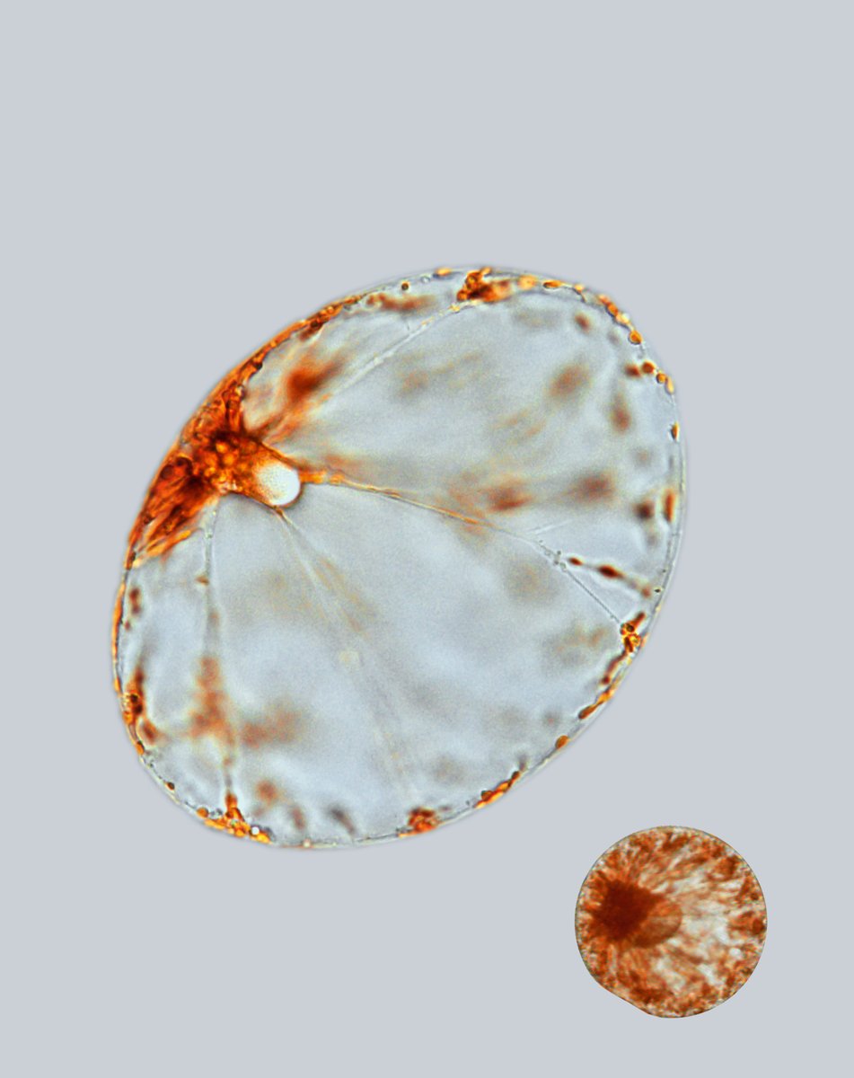 Cell Press (@cellpressnews) on Twitter photo Deep sea phytoplankton observed ballooning to 6x their size in order to float to the surface to capture sunlight.
<a href="/CurrentBiology/">Current Biology</a>
Learn more: cell.com/current-biolog…
@Planktonico <a href="/ManuPra18599785/">Manu Prakash</a> <a href="/PrakashLab/">PrakashLab</a> Deep sea phytoplankton observed ballooning to 6x their size in order to float to the surface to capture sunlight.
<a href="/CurrentBiology/">Current Biology</a>
Learn more: cell.com/current-biolog…
@Planktonico <a href="/ManuPra18599785/">Manu Prakash</a> <a href="/PrakashLab/">PrakashLab</a>