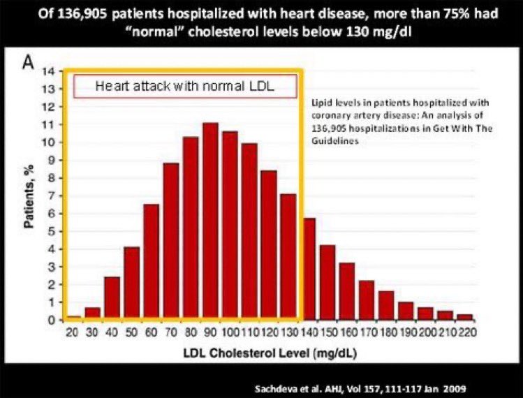 altcap's tweet image. How is it that the #1 killer in the world is nearly 90% preventable?  I blame on the mis-information / focus on cholesterol.  Half of heart deaths have normal cholesterol!  A Calcium CT Scan is the best 15 mins &amp;amp; $200 u could possible spend to extend your life.  Get it done! 🤍🙏