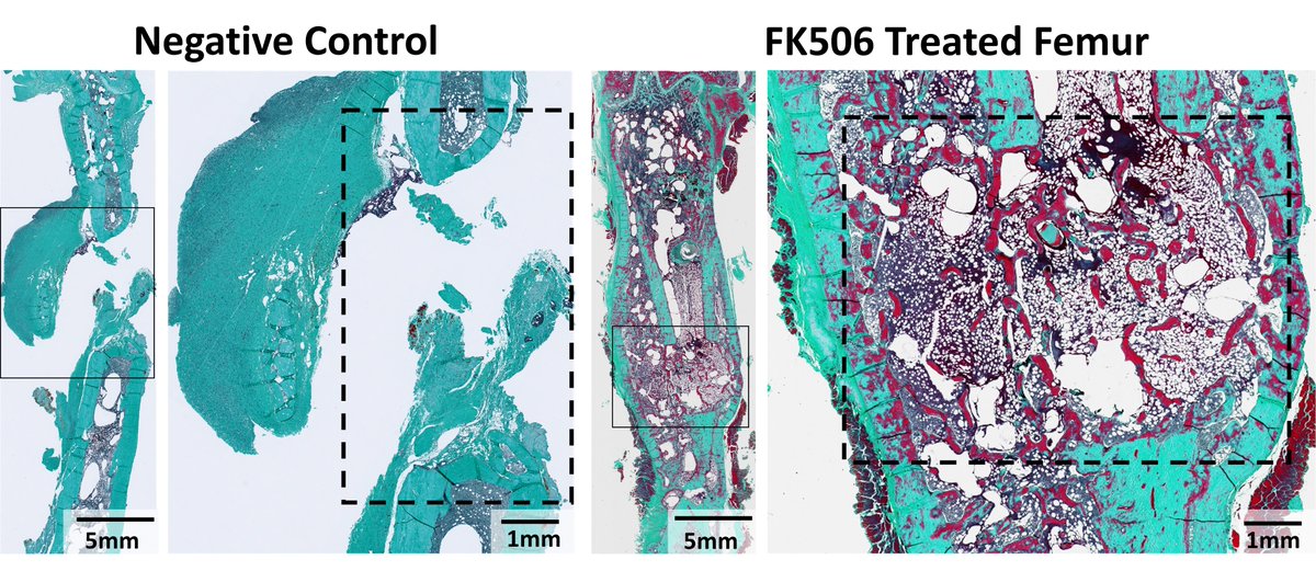 New work from the <a href="/WillettLabs/">Nick Willett</a> , led by
<a href="/AndracaJulia/">Julia Andraca Harrer</a> , explores how the immunosuppressive drug Tacrolimus (FK506) can speed up regeneration in a spinal fusion model—achieving fusion rates comparable to BMP. 💊📷 

Read more here: knightcampus.uoregon.edu/old-dog-new-tr…