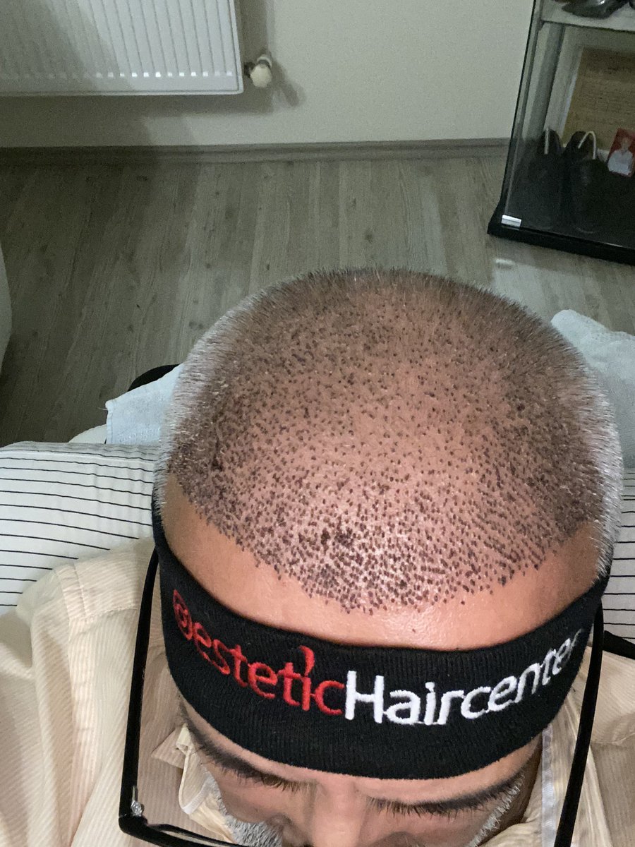 AMATÖR BORSACI tweet media