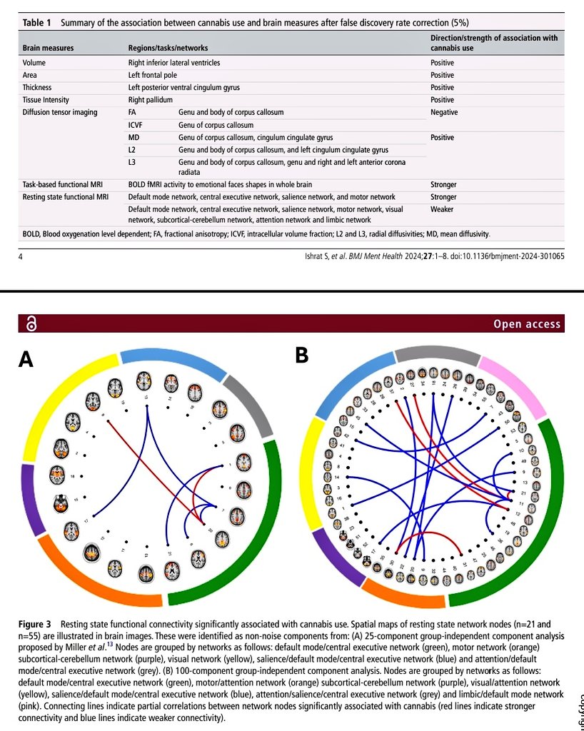 BMJ Mental Health (@bmjmentalhealth) on Twitter photo This article explores the association between #cannabis use & #brain structure & function in #older #adults through #observational & #Mendelian #randomisation studies.
<a href="/sabaishrat4/">Saba Ishrat</a> <a href="/dflevey1/">Dan Levey</a> <a href="/AnyaTopiwala/">Dr Anya Topiwala</a> <a href="/OxPsychiatry/">Oxford Psychiatry</a> <a href="/UniofOxford/">University of Oxford</a> <a href="/StCrossCollege/">St Cross College</a>
To access the full This article explores the association between #cannabis use & #brain structure & function in #older #adults through #observational & #Mendelian #randomisation studies.
<a href="/sabaishrat4/">Saba Ishrat</a> <a href="/dflevey1/">Dan Levey</a> <a href="/AnyaTopiwala/">Dr Anya Topiwala</a> <a href="/OxPsychiatry/">Oxford Psychiatry</a> <a href="/UniofOxford/">University of Oxford</a> <a href="/StCrossCollege/">St Cross College</a>
To access the full