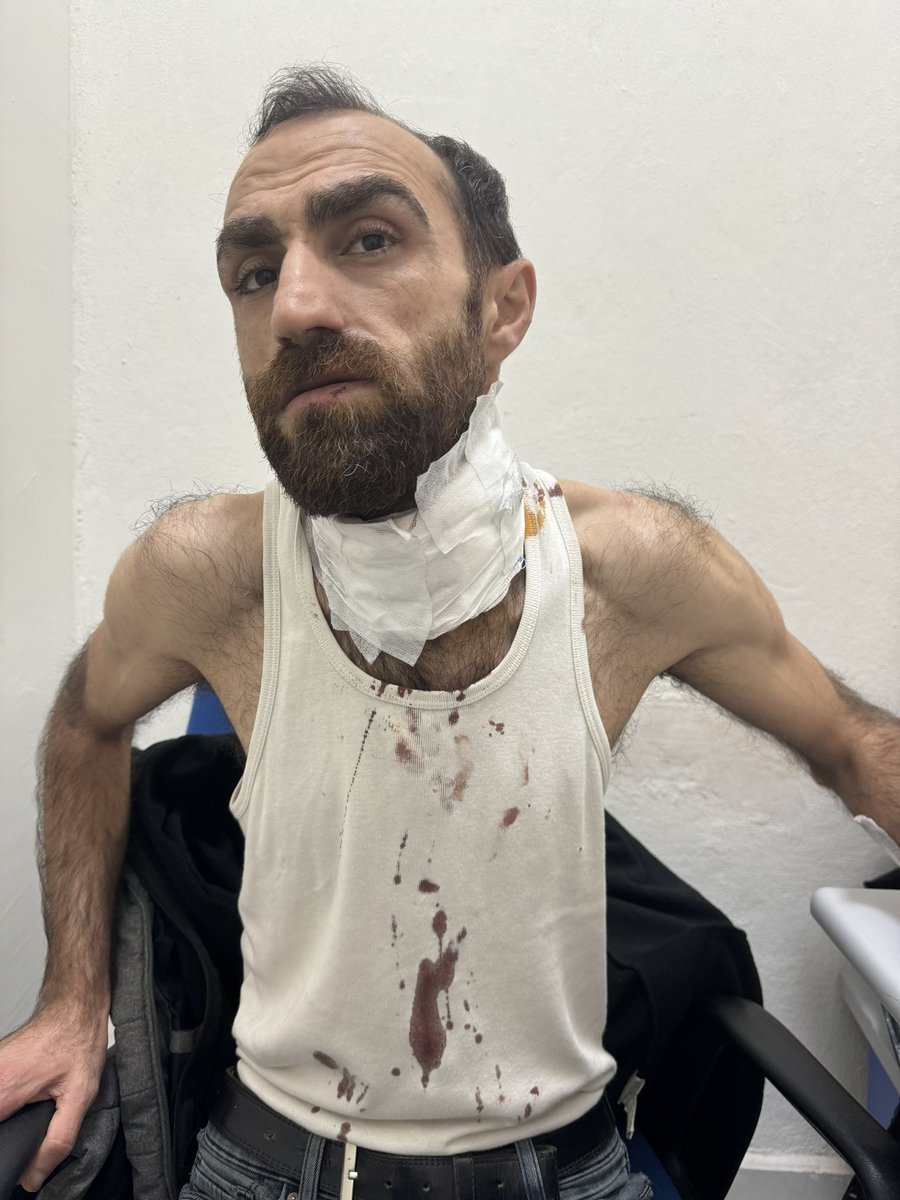 av_Veliogurlu's tweet photo. Müvekkilim boynunda 11 dikiş ile gözaltında 
Atk şube doktoru ceza ehliyeti tam dedi.
Normal yemek yiyemiyor ve sıvı yemek götürme talebimiz soruşturma savcısının talimatı ile engelleniyor. Sağlık durumu kötü ve aç bitap nezarette kalıyor. Kamuoyuna Duyarlılık Çağrımız Var. https://t.co/KjcbvdRRme