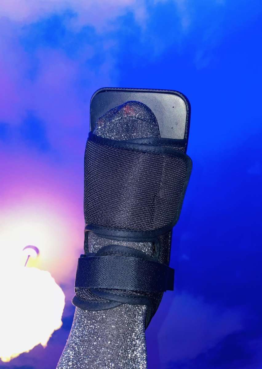 Broken big toe- so trying to rock the orthopaedic sandal in a disco fashion. #glittersocks 6/8 weeks to heal. #ehlersdanlossyndrome