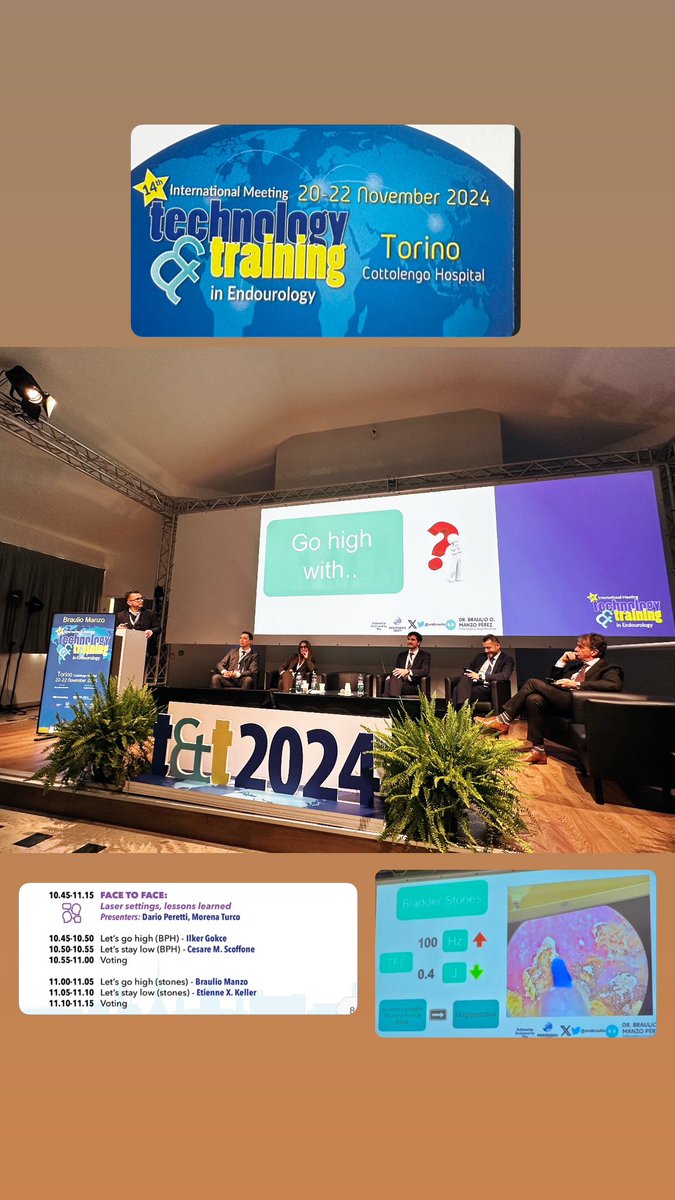 Daniela Méndez Guerrero (@mendezdanielam) on Twitter photo Laser parameters: how to make the most of this technology and optimize your surgical outcomes.<a href="/urobraulio/">MD Braulio O. Manzo</a>
#T&T2024
<a href="/NishiEndouro/">Jorge Kazuo Nishimura Almaguer</a> Laser parameters: how to make the most of this technology and optimize your surgical outcomes.<a href="/urobraulio/">MD Braulio O. Manzo</a>
#T&T2024
<a href="/NishiEndouro/">Jorge Kazuo Nishimura Almaguer</a>