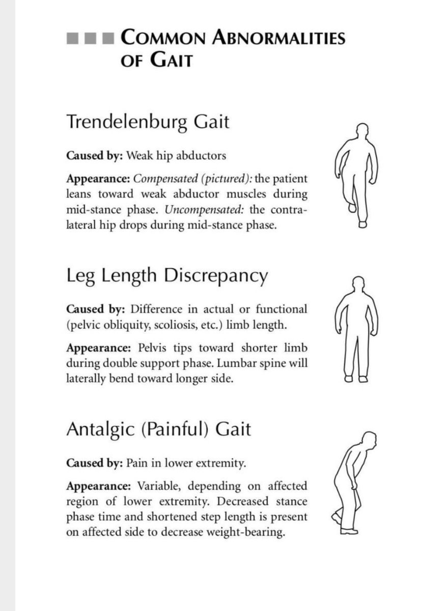 PT__world's tweet photo. Common abnormalities of gait https://t.co/7YUTiINnVt