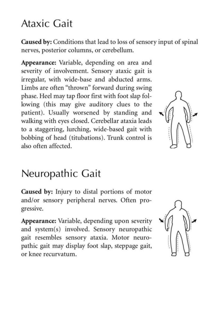 PT__world's tweet photo. Common abnormalities of gait https://t.co/7YUTiINnVt