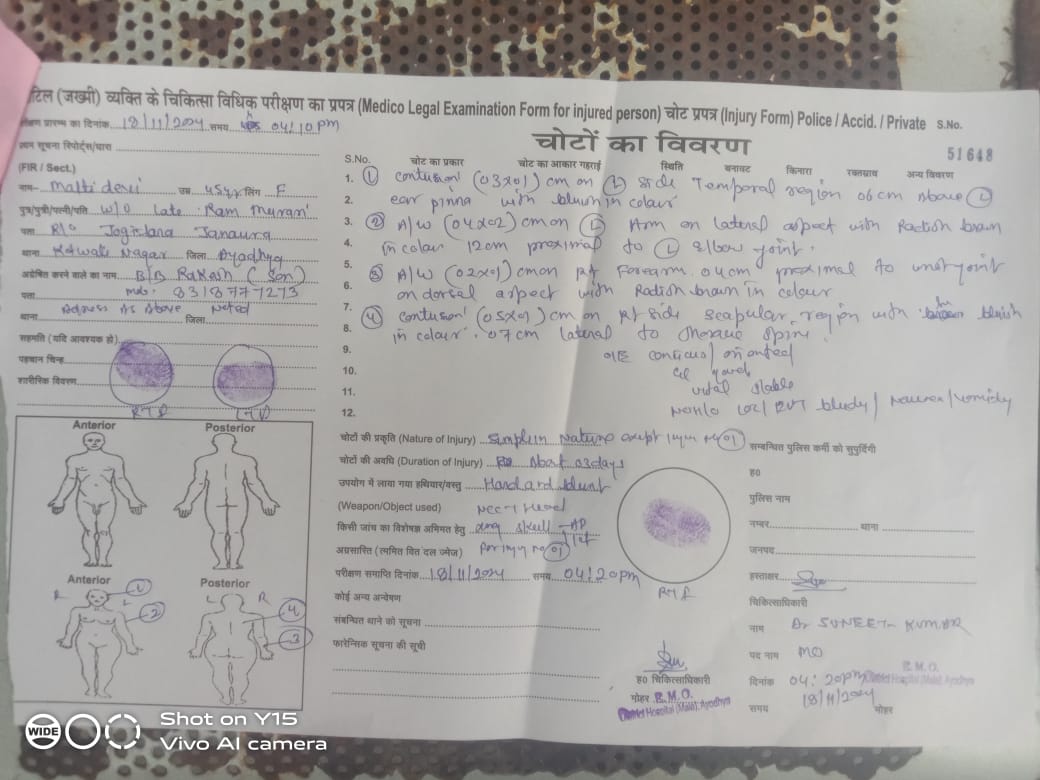 अयोध्या थाना कोतवाली नगर के अंतर्गत गोबर पाथने को लेकर महिलाओ में हुआ विवाद विपक्षी के द्वारा महिलाओ को भद्दी भद्दी गाली देते हुए मारा पीटा और जान से मारने की धमकीं दी <a href="/ayodhya_police/">AYODHYA POLICE</a> प्रशाशन उच्चित कार्यवाही करे..
<a href="/Uppolice/">UP POLICE</a> <a href="/igrangeayodhya/">DIG Range Ayodhya</a> <a href="/ayodhya_police/">AYODHYA POLICE</a>