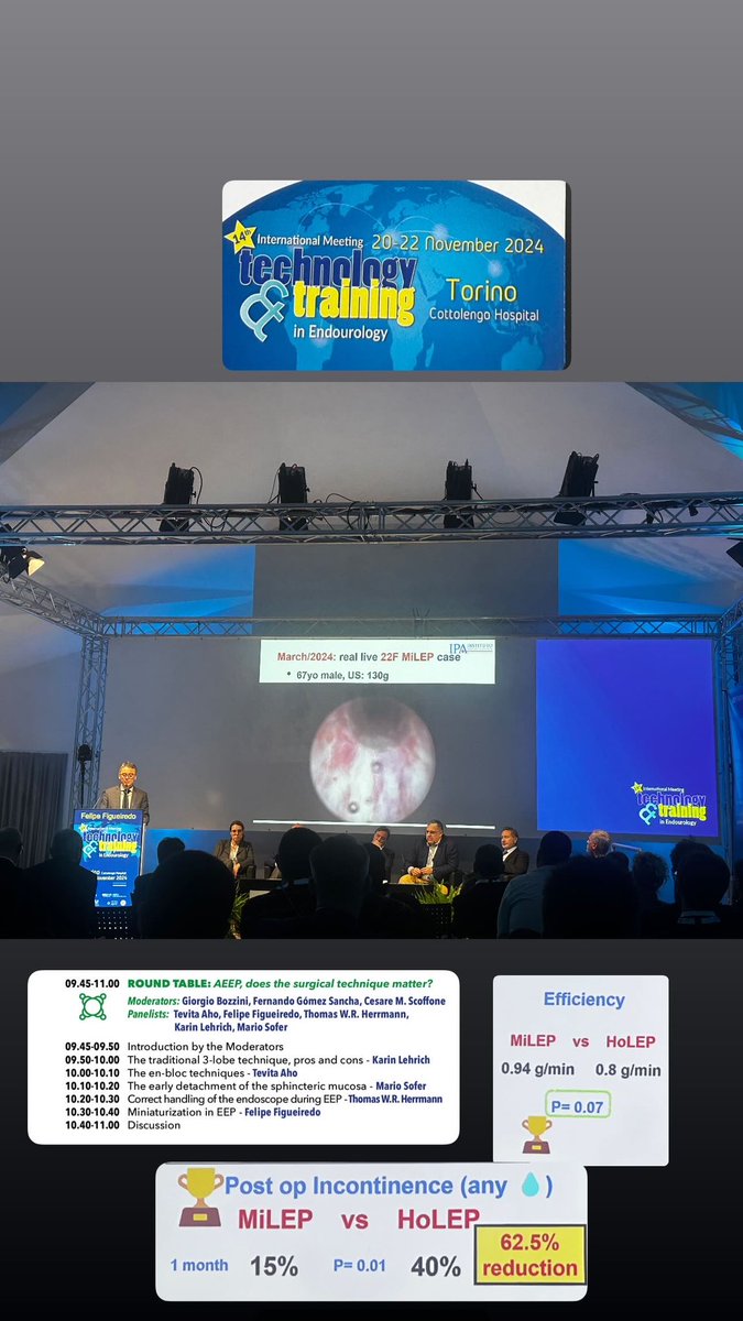 Daniela Méndez Guerrero (@mendezdanielam) on Twitter photo Exploring techniques and technology in HoLEP, T&T. <a href="/FCAFigueiredo/">Felipe Figueiredo HoLEP 🇧🇷</a>, MiLEP vs. HoLEP. Benefits of smaller-caliber equipment.
<a href="/urobraulio/">MD Braulio O. Manzo</a> <a href="/NishiEndouro/">Jorge Kazuo Nishimura Almaguer</a> Exploring techniques and technology in HoLEP, T&T. <a href="/FCAFigueiredo/">Felipe Figueiredo HoLEP 🇧🇷</a>, MiLEP vs. HoLEP. Benefits of smaller-caliber equipment.
<a href="/urobraulio/">MD Braulio O. Manzo</a> <a href="/NishiEndouro/">Jorge Kazuo Nishimura Almaguer</a>