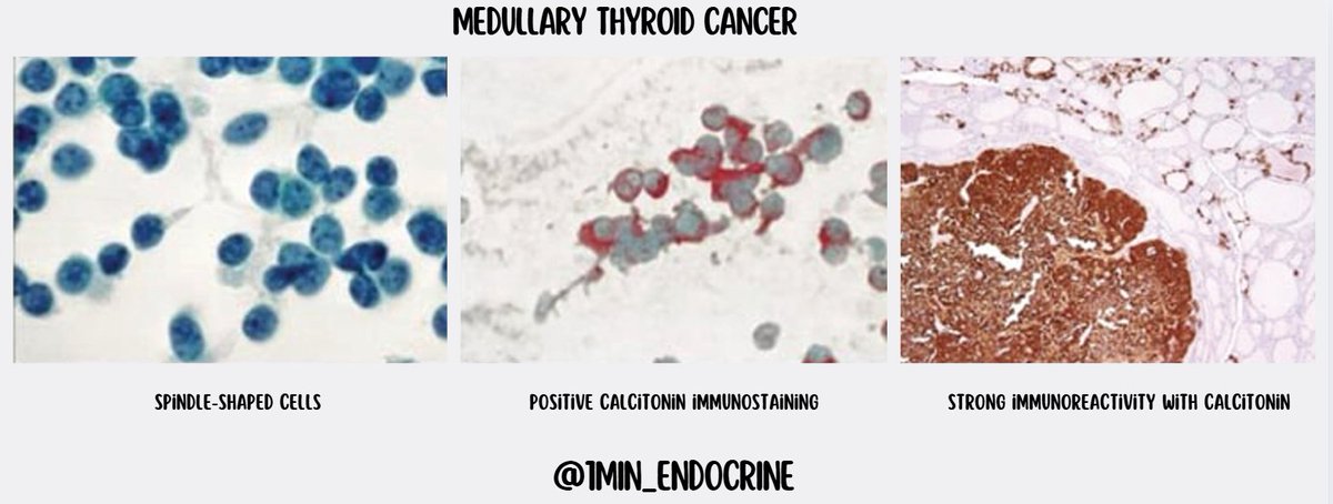 1MIN_ENDOCRINE's tweet photo. https://t.co/RxjTJKywv9