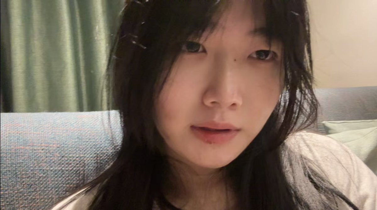 剌个双眼皮会不会更好？