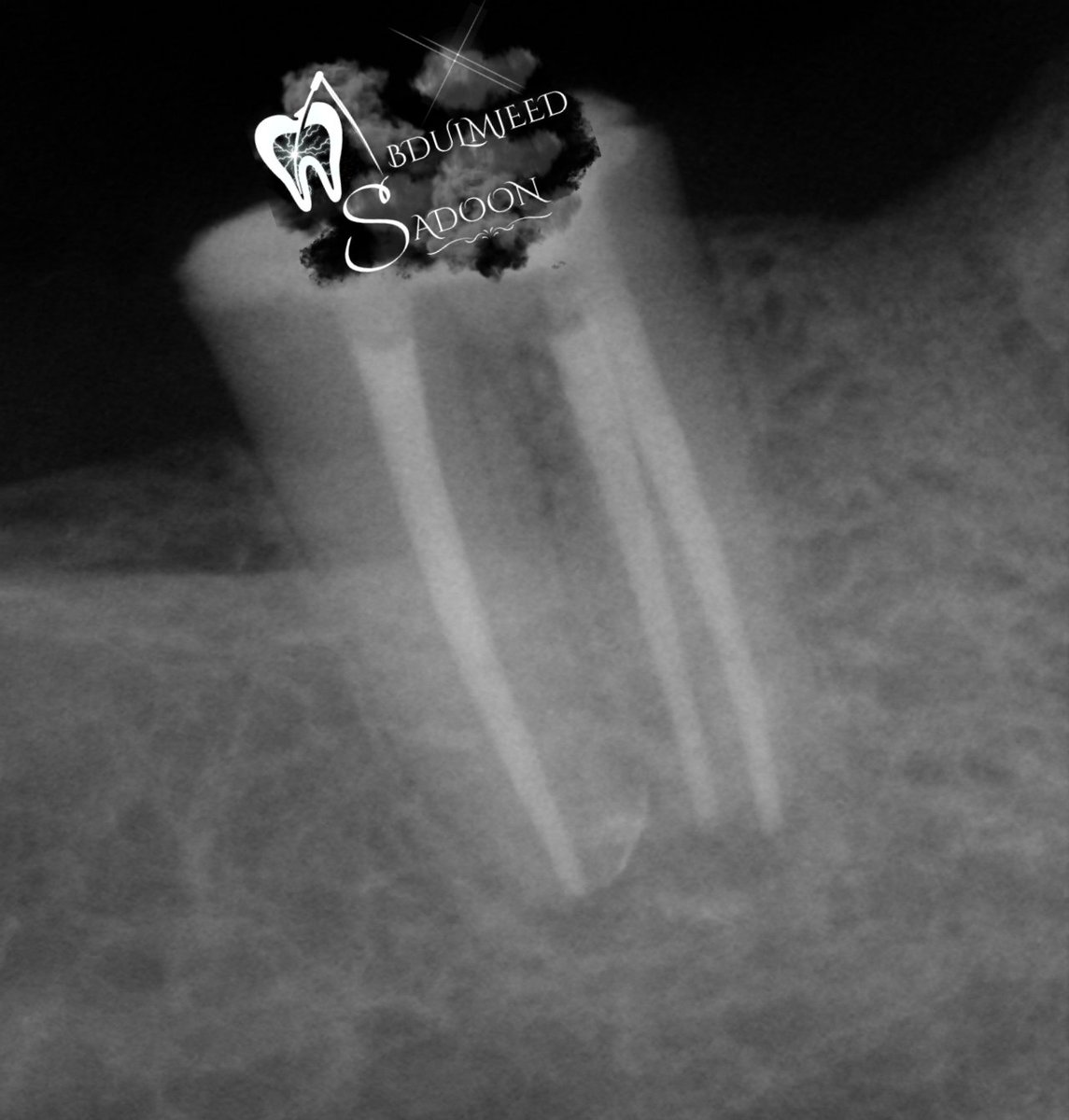ما يتمناه كل طبيب/طالب أسنان وقت امتحان العملي للاندو 😂