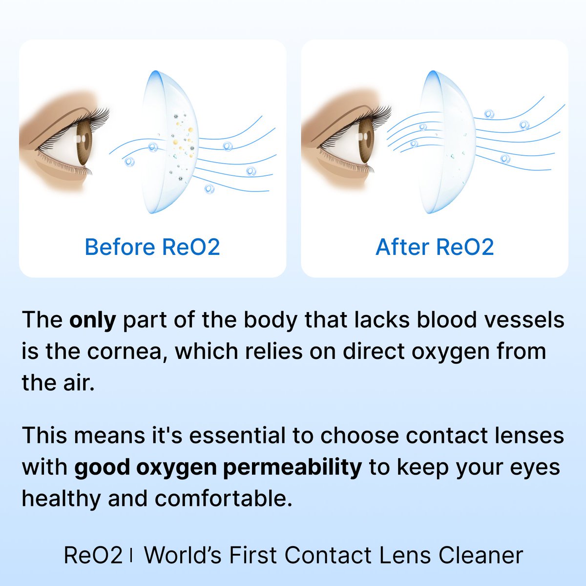 3NEyecare's tweet photo. The only part of the body that lacks blood vessels is the cornea, which relies on direct oxygen from the air. #eye https://t.co/ikc4CnmJt4