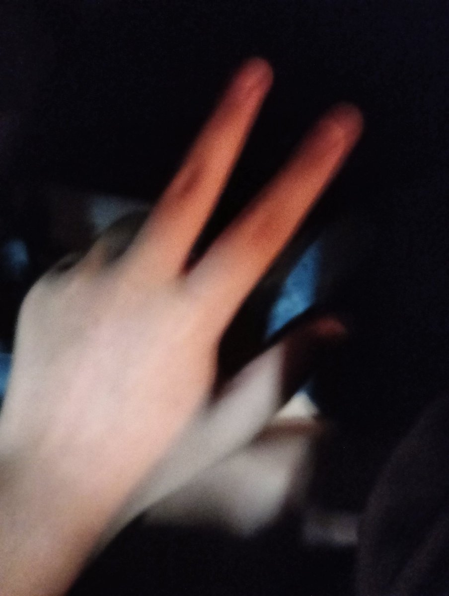 Dkkdkdfkkf44544's tweet photo. รูปเมื่อหลายคืนก่อน #myhand #Knp🐈🖤🤍 #Knp #Knplil #knpクンプ https://t.co/oiuA9G6a18