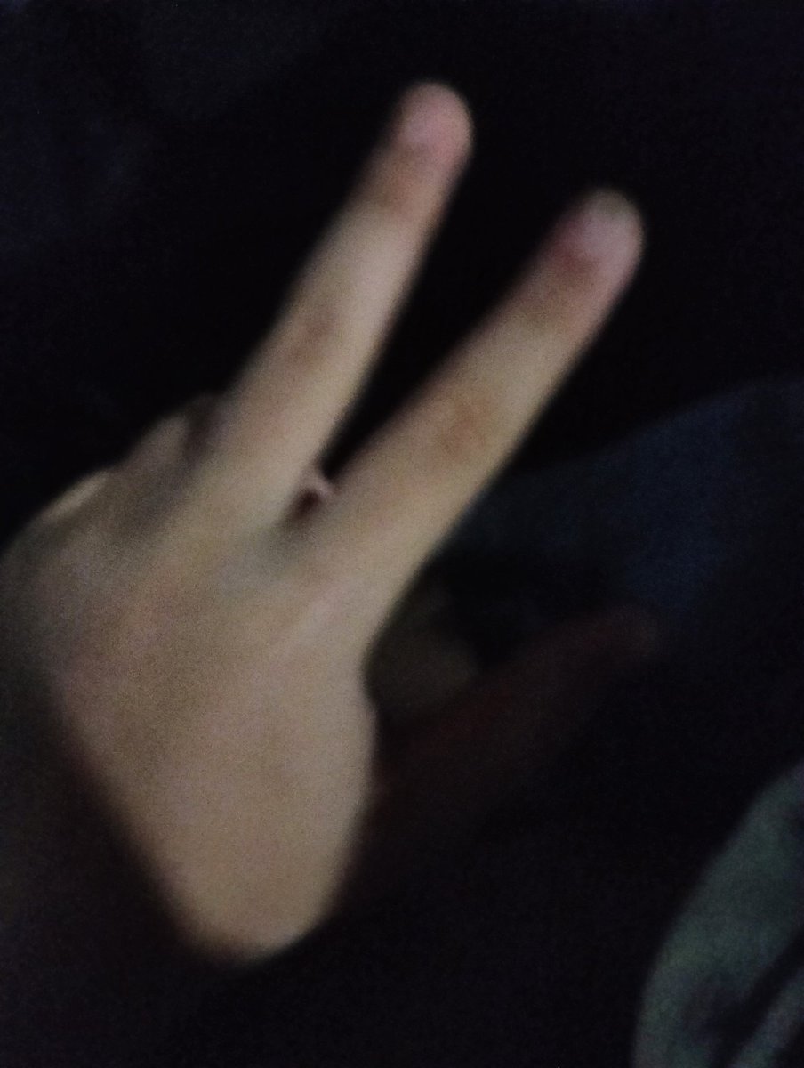 Dkkdkdfkkf44544's tweet photo. รูปเมื่อหลายคืนก่อน #myhand #Knp🐈🖤🤍 #Knp #Knplil #knpクンプ https://t.co/oiuA9G6a18