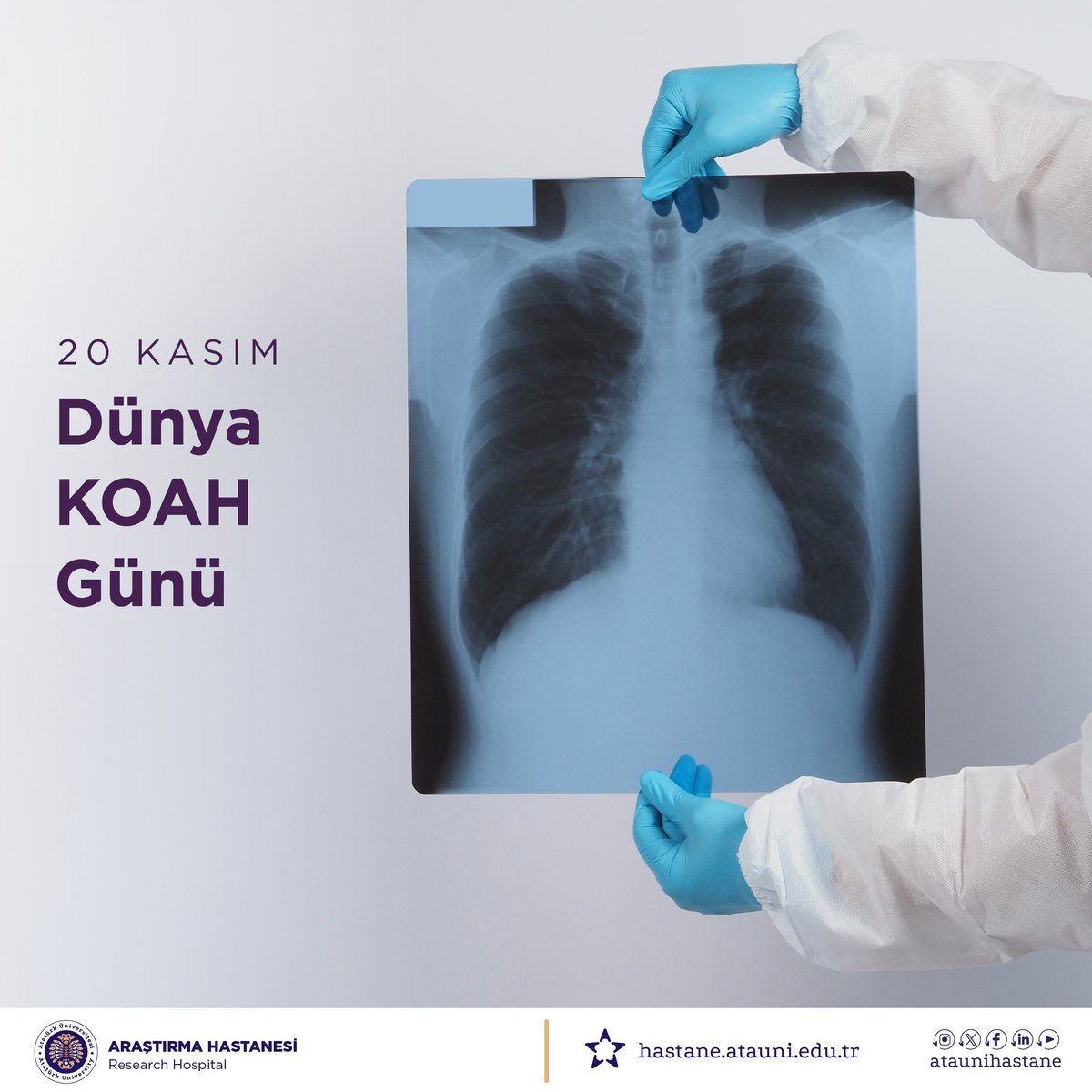 ataunihastane's tweet photo. KOAH, erken tanı ve tedaviyle kontrol altına alınabilir bir hastalıktır. Tütün ürünlerinden uzak durarak ve düzenli sağlık kontrolleriyle solunum sağlığınızı koruyun.
@atauni1957
#DünyaKOAHGünü #sağlık #solunum https://t.co/DqHgUXlDyI