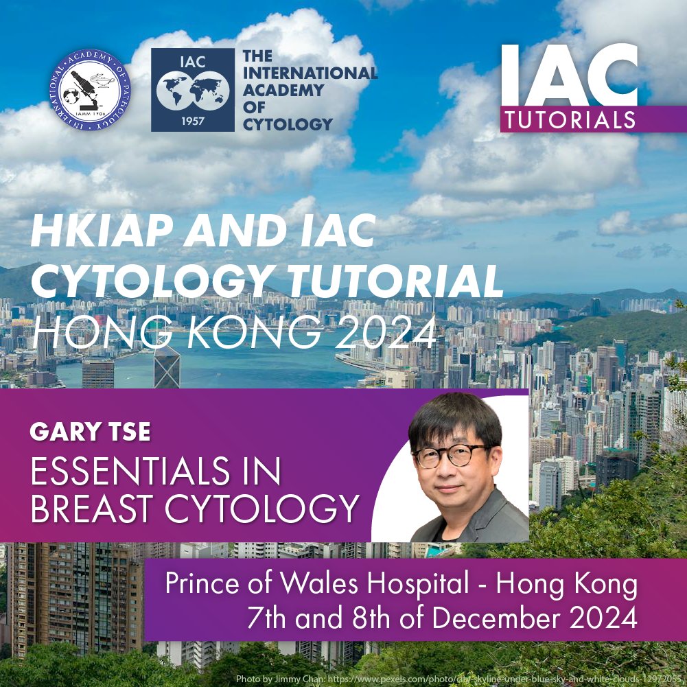 IACytology's tweet image. Pls RT #Breast Cytology is one of the most popular topics in cytology &amp;amp; cytopathology circles. So you should register for our #IACTutorial on 7th &amp;amp; 8th Dec in Hong Kong hkiap.org/wp-content/upl…