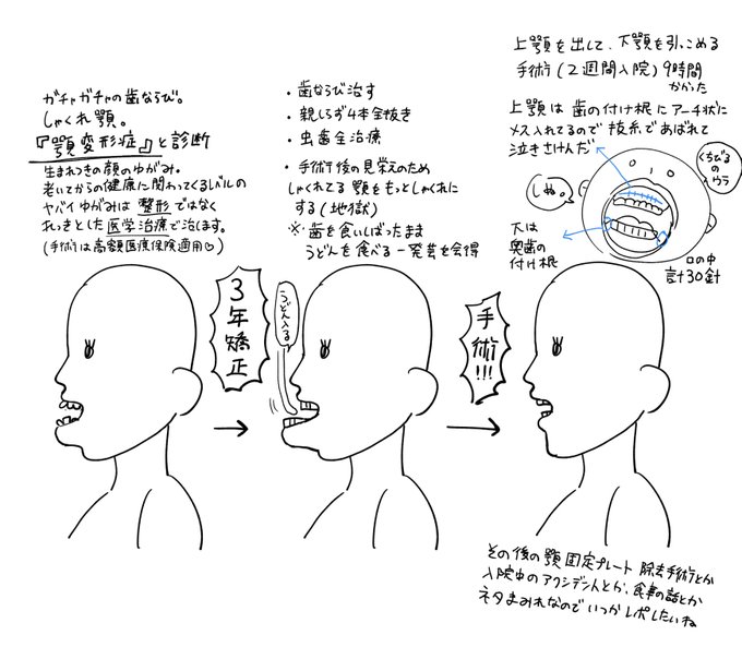 過去に顔面大手術した 