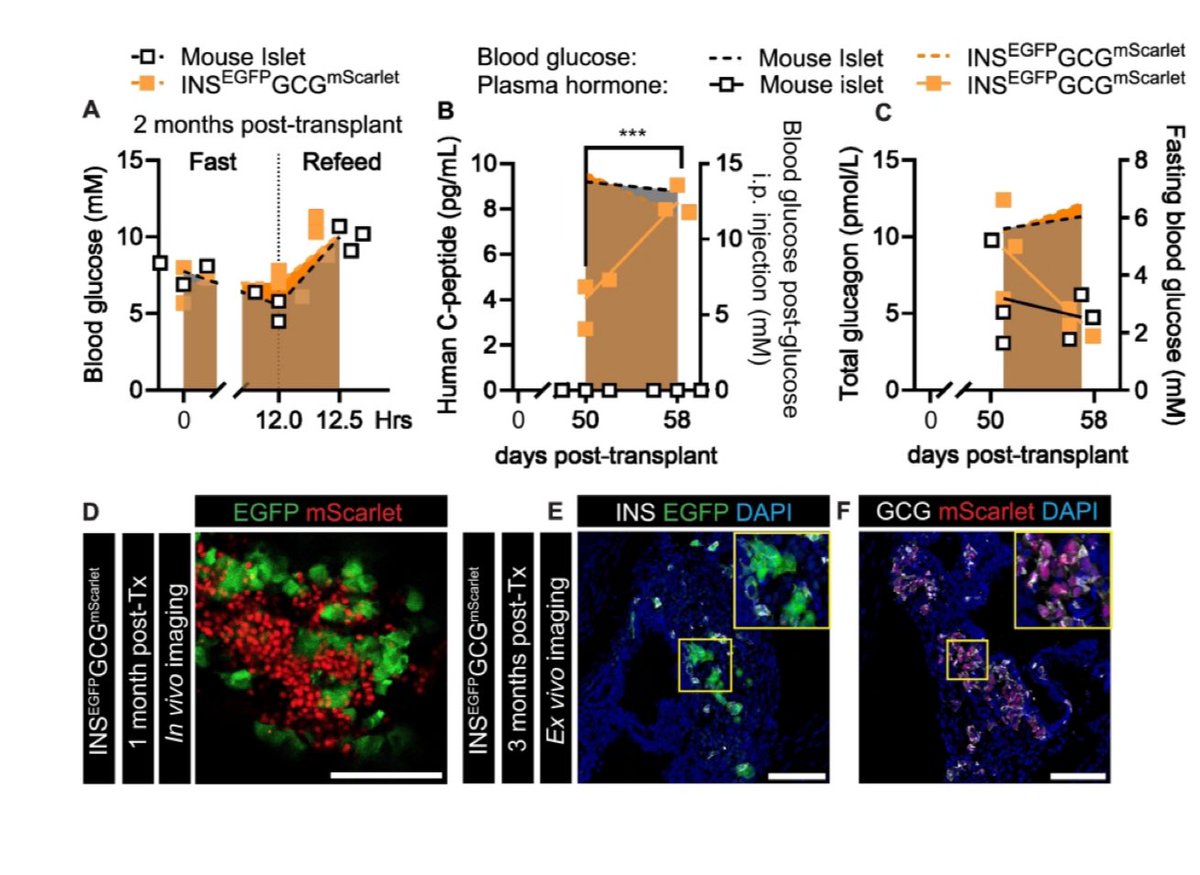 Daniel J Drucker (@danieljdrucker) on Twitter photo The INSEGFPGCGmScarlet hESC line provides an efficient strategy for tracking populations of hESC-derived beta- and alpha-like cells #islets @nictitate <a href="/Diabetes_ADA/">Diabetes, a research journal of the ADA 🧪</a> pubmed.ncbi.nlm.nih.gov/39561351/ The INSEGFPGCGmScarlet hESC line provides an efficient strategy for tracking populations of hESC-derived beta- and alpha-like cells #islets @nictitate <a href="/Diabetes_ADA/">Diabetes, a research journal of the ADA 🧪</a> pubmed.ncbi.nlm.nih.gov/39561351/