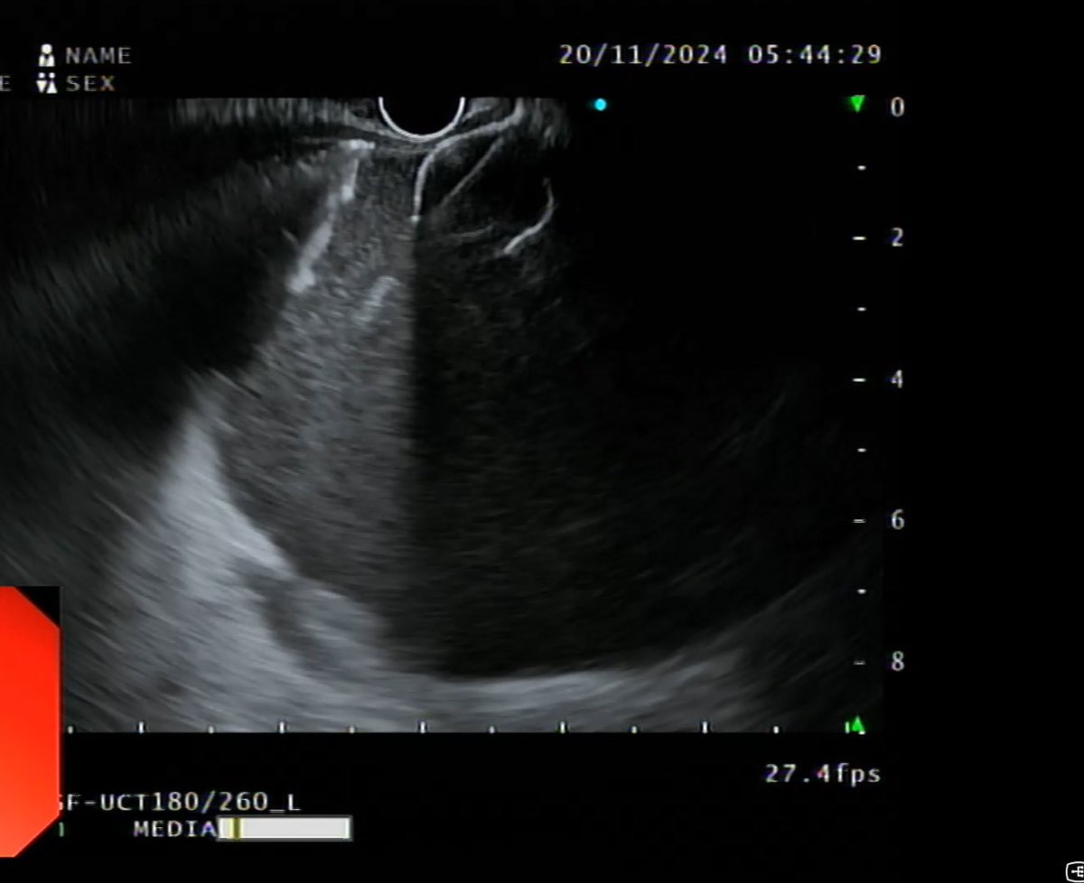 Srinu Deshidi tweet media