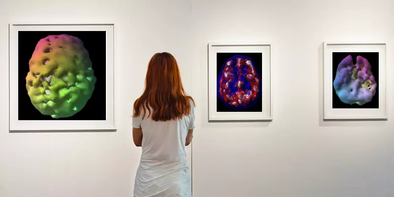 DocAmen's tweet image. Brain SPECT scans can help people understand why they are experiencing mental health issues. Plus, brain scans can aid mental health professionals in treating. #SPECT #BrainScan #AmenClinics bit.ly/4ejVhSP