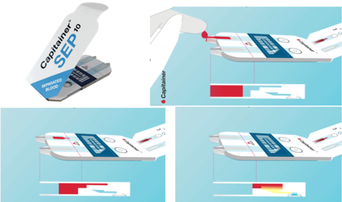 Stratech_UK's tweet photo. .#Capitainer®SEP10 collects a measured volume of #blood and separates the #cells without centrifugation to generate a #plasma-like sample for testing of substances that can’t be measured from whole blood. #bloodsampling #diagnostics 🩸🔬
🔗https://t.co/GIOpPXIyvl https://t.co/qIDFV8JlG2