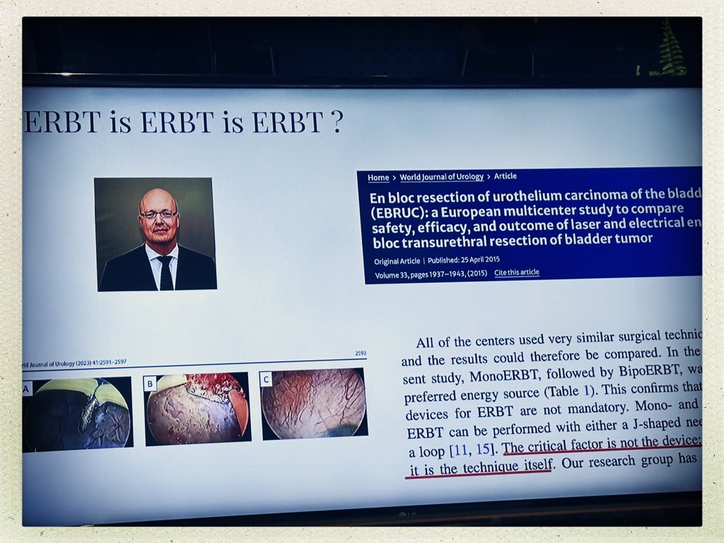 trwherrmann's tweet photo. I like it and would strongly agree. #ERBT #TNT24 @EndourologyT @scoffonecesare I would exclude #ESD from this phrase #NMIBC Slide from Tiago Horta’s talk on the impact of energy sources in #enbloc resection of bladder tumours. Energy source is secondary. Anatomy is paramount https://t.co/i2cjkAX6fm