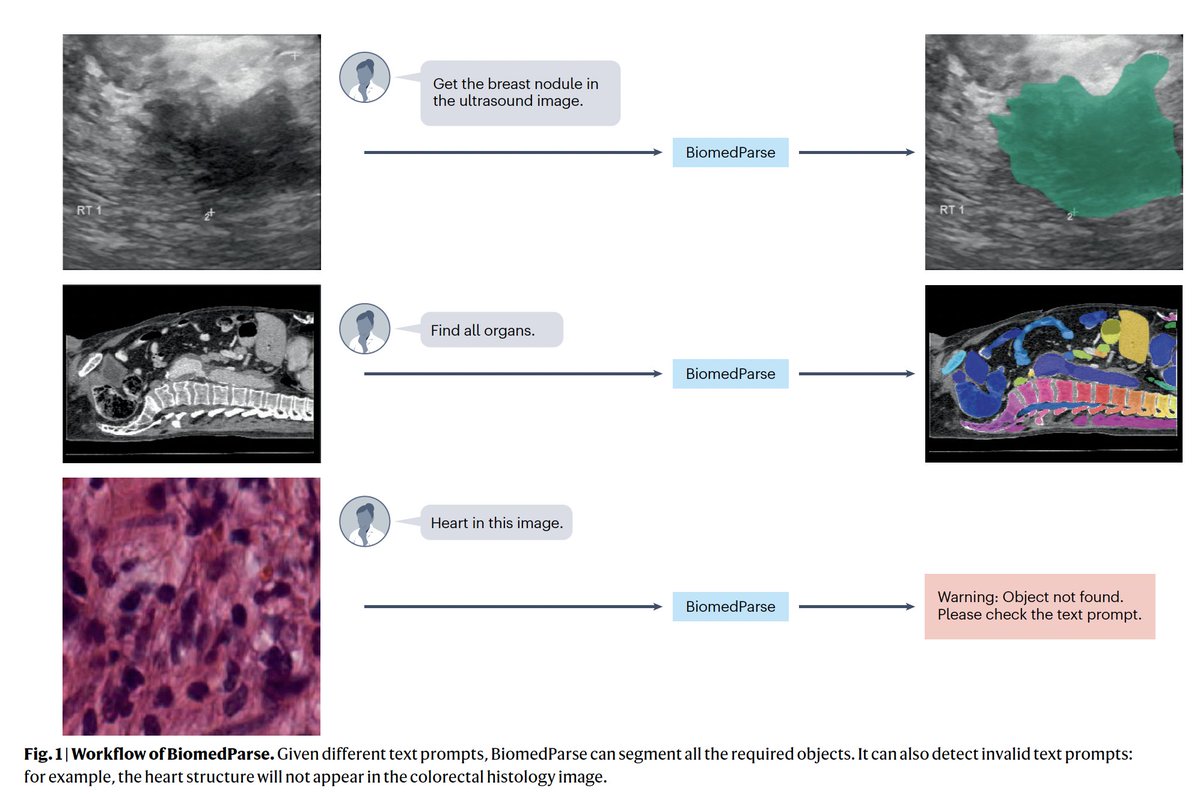 External validation of BiomedParse foundation #AI model across 9 types of medical images, automatically identifying all objects at once and saving hours of manual work, reducing errors
nature.com/articles/s4159…
@NatureMethods 
"The implications of BiomedParse are profound"