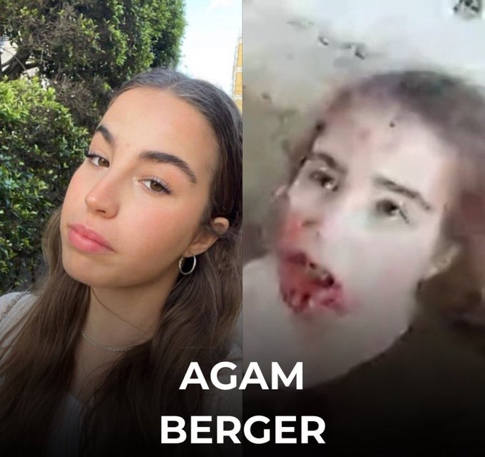 This is Agam Berger. She is only 20 years old.  

This is what Hamas has done to her.  

It's been 411 days since she was taken to the hell-hole of Gaza, where she is likely being tortured physically and mentally by those demons—Hamas.  

Don’t let Agam be forgotten.