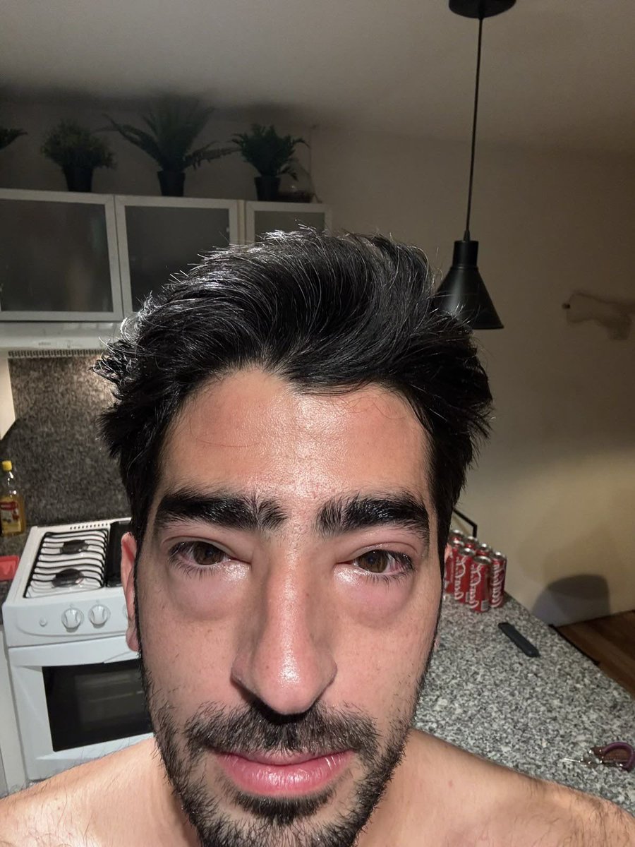 Miércoles 20 de noviembre a las 9 am y ya estoy así: