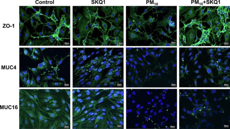 Wayne OVAS/Kresge Eye Institute/Wayne Health (@waynestateovas) on Twitter photo A recent study from <a href="/LindaHazlett7/">Linda Hazlett</a> lab provides insights into how airborne particulate matter (PM10) disrupts the corneal epithelial barriers. Antioxidant SKQ1 reverses these effects, offering a potential protective strategy. Link to full paper: doi.org/10.1016/j.taap… A recent study from <a href="/LindaHazlett7/">Linda Hazlett</a> lab provides insights into how airborne particulate matter (PM10) disrupts the corneal epithelial barriers. Antioxidant SKQ1 reverses these effects, offering a potential protective strategy. Link to full paper: doi.org/10.1016/j.taap…