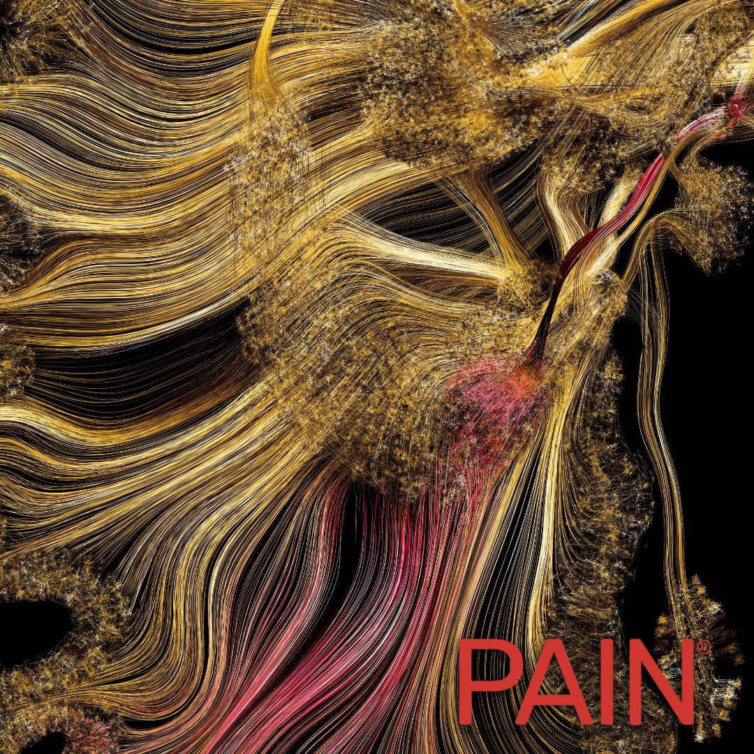 IASP (@iasppain) on Twitter photo This month’s #PAIN cover features stunning artwork by @gdunnart. At center is the nucleus accumbens, the brain region in which @vannazachariou <a href="/ra_serafini/">Alex Serafini, PhD/MHA</a> et al. overexpressed MEF2C in order to alleviate pain and anxiety-like behaviors. Learn more at bit.ly/3UOxIe2 This month’s #PAIN cover features stunning artwork by @gdunnart. At center is the nucleus accumbens, the brain region in which @vannazachariou <a href="/ra_serafini/">Alex Serafini, PhD/MHA</a> et al. overexpressed MEF2C in order to alleviate pain and anxiety-like behaviors. Learn more at bit.ly/3UOxIe2