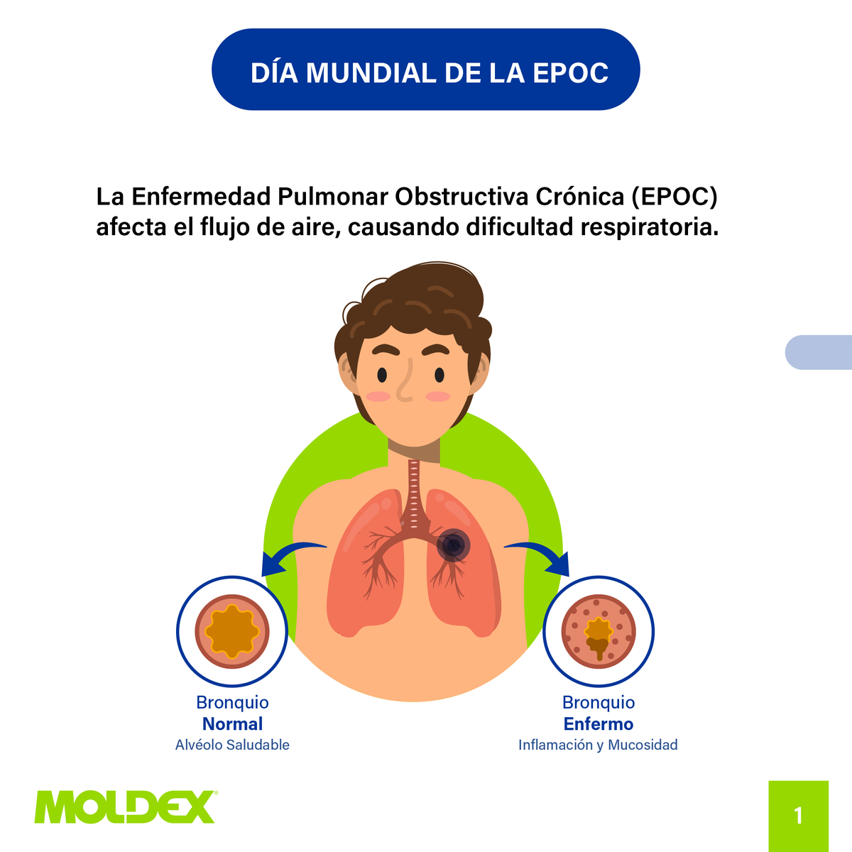 Moldex_AmLat's tweet photo. 🌬️En el Día Mundial de la EPOC, cuidemos nuestros pulmones.
Factores como el tabaco 🚬, la contaminación 🌫️ y la exposición laboral 🏭 pueden causar daños irreversibles.
💙 En Moldex, te ofrecemos soluciones en protección respiratoria.
#Moldex #EPOC #Salud #EHS #EPP https://t.co/G8ZLztIr0Y