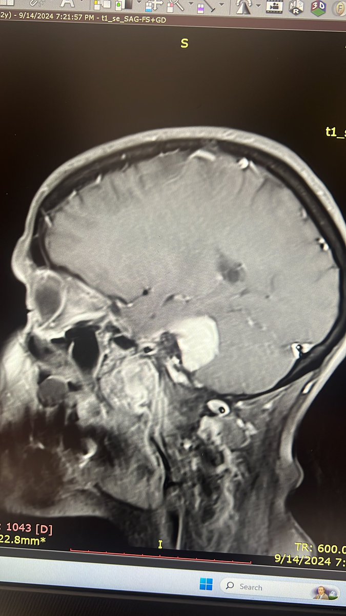 GuiveSharifi's tweet photo. 42 years old woman with hx of hearing loss 
Dx? Approach? https://t.co/FynU38P8mv