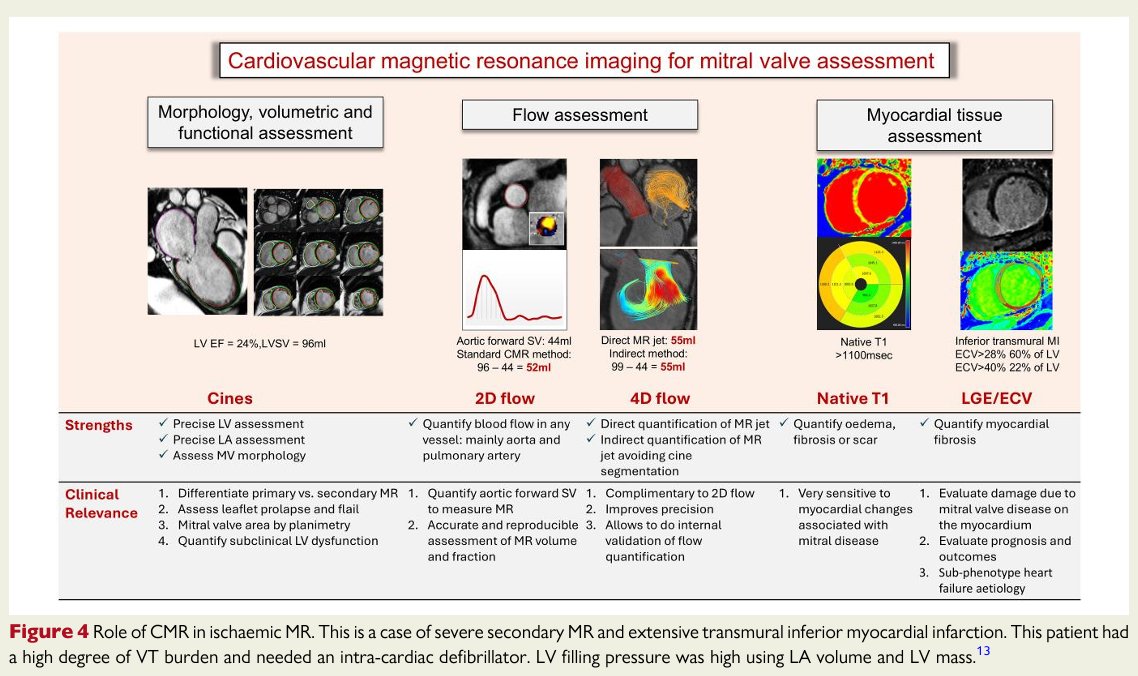 HEARTinMagnet's tweet image. STATE-OF-THE-ART REVIEW IN @ehj_ed  
🫀#whycmr in Mitral Valve Disease.🫀
Training videos included! 📽️
academic.oup.com/eurheartj/arti…

@seth_uretsky @SCMRorg @BSCMR @WHYCMR_BOT @vass_vassiliou @Doc_Tiger @dr_manisty @cshenoy3 @AmitRPatelMD @JGrapsa @escardio @ESC_Journals @DipanJShah