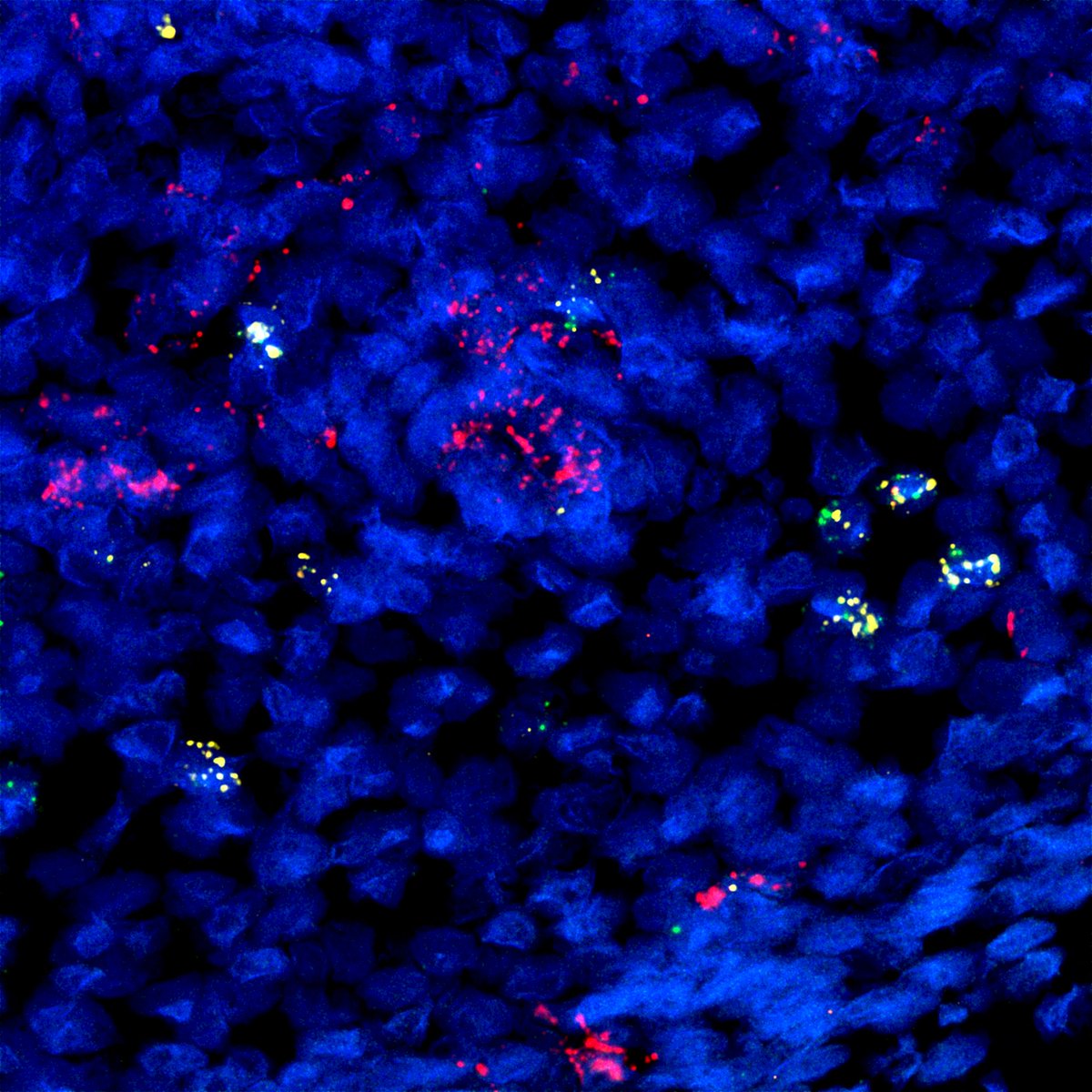 CZI Science (@cziscience) on Twitter photo “The <a href="/humancellatlas/">Human Cell Atlas</a> was one of <a href="/ChanZuckerberg/">Chan Zuckerberg Initiative</a>’s first big bets in science, & these landmark papers are a testament to the power of collaboration.” –Steve Quake, Head of Science “The <a href="/humancellatlas/">Human Cell Atlas</a> was one of <a href="/ChanZuckerberg/">Chan Zuckerberg Initiative</a>’s first big bets in science, & these landmark papers are a testament to the power of collaboration.” –Steve Quake, Head of Science