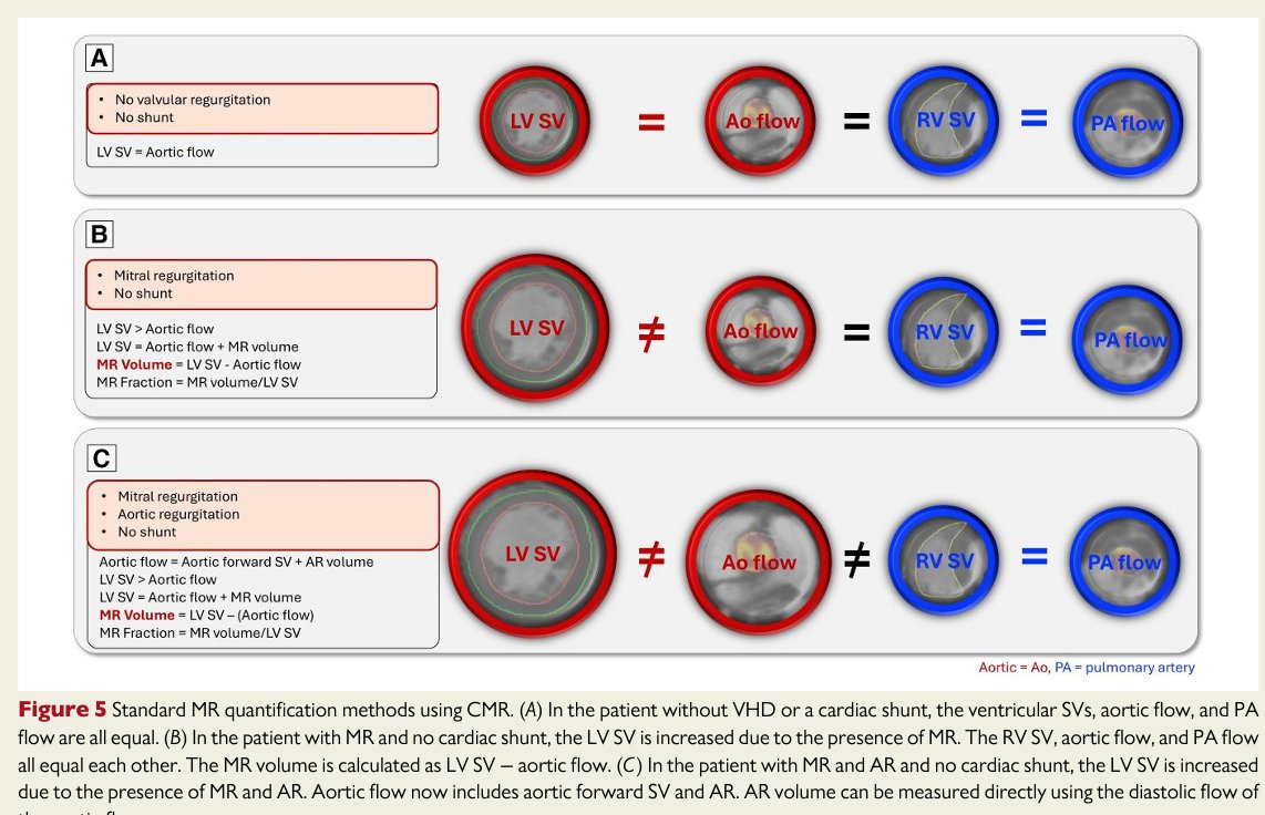 Pankaj Garg (@heartinmagnet) on Twitter photo STATE-OF-THE-ART REVIEW IN <a href="/ehj_ed/">EHJ Editor-in-Chief</a>
🫀#whycmr in Mitral Valve Disease.🫀
Training videos included! 📽️
academic.oup.com/eurheartj/arti…
<a href="/seth_uretsky/">Seth Uretsky</a> <a href="/SCMRorg/">Society for Cardiovascular Magnetic Resonance</a> <a href="/BSCMR/">BSCMR</a> <a href="/WHYCMR_BOT/">WHYCMR-BOT</a> <a href="/vass_vassiliou/">Vass Vassiliou</a> <a href="/Doc_Tiger/">Manish Motwani</a> <a href="/dr_manisty/">Charlotte Manisty</a> <a href="/cshenoy3/">Chetan Shenoy</a> <a href="/AmitRPatelMD/">Amit R. Patel</a> <a href="/JGrapsa/">Julia Grapsa MD, PhD</a> <a href="/escardio/">European Society of Cardiology</a> <a href="/ESC_Journals/">European Society of Cardiology Journals</a> <a href="/DipanJShah/">Dipan J. Shah, MD</a> STATE-OF-THE-ART REVIEW IN <a href="/ehj_ed/">EHJ Editor-in-Chief</a>
🫀#whycmr in Mitral Valve Disease.🫀
Training videos included! 📽️
academic.oup.com/eurheartj/arti…
<a href="/seth_uretsky/">Seth Uretsky</a> <a href="/SCMRorg/">Society for Cardiovascular Magnetic Resonance</a> <a href="/BSCMR/">BSCMR</a> <a href="/WHYCMR_BOT/">WHYCMR-BOT</a> <a href="/vass_vassiliou/">Vass Vassiliou</a> <a href="/Doc_Tiger/">Manish Motwani</a> <a href="/dr_manisty/">Charlotte Manisty</a> <a href="/cshenoy3/">Chetan Shenoy</a> <a href="/AmitRPatelMD/">Amit R. Patel</a> <a href="/JGrapsa/">Julia Grapsa MD, PhD</a> <a href="/escardio/">European Society of Cardiology</a> <a href="/ESC_Journals/">European Society of Cardiology Journals</a> <a href="/DipanJShah/">Dipan J. Shah, MD</a>