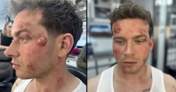 BTS of Oliver for ‘9-1-1’ 8x05! #911onABC