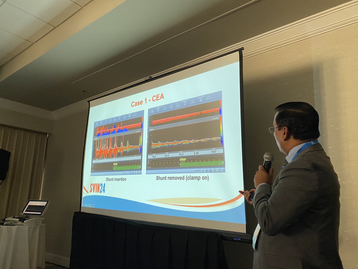 Packed house at the vascular sonography workshop this morning! Our best attendance at an ultrasound session at SVIN. Can’t thank the speakers, sponsors, and attendees enough! We need more TCD certified physicians in real world practice! #SVIN24