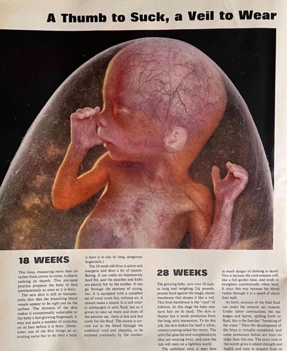 annamlulis's tweet photo. Modern media: “They’re just a clump of cells”

Life Magazine, 1965: https://t.co/rzRECj1dwg