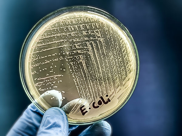 ACS Pressroom (@acspressroom) on Twitter photo An innovative antimicrobial compound that could target drug-resistant pathogens like E. coli inhibited several bacterial infections in animal trials. The study was published in <a href="/ACSBioMed/">ACS Publications Bio & Med Chem Content</a> during #WAAW 2024: brnw.ch/21wOPas #AMR #AntimicrobialResistance An innovative antimicrobial compound that could target drug-resistant pathogens like E. coli inhibited several bacterial infections in animal trials. The study was published in <a href="/ACSBioMed/">ACS Publications Bio & Med Chem Content</a> during #WAAW 2024: brnw.ch/21wOPas #AMR #AntimicrobialResistance