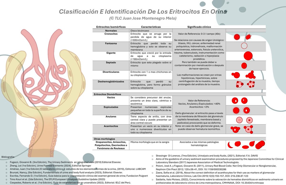 <a href="/SENefrologia/">S.E.N. Nefrología</a> <a href="/FeerMadrigalM/">TheChemistry ☣️🧬</a> <a href="/QFB_Daniel/">Francisco Naranjo</a> <a href="/VelezNephHepato/">Juan Carlos Q Velez</a> <a href="/SENefrologia/">S.E.N. Nefrología</a> <a href="/JoseTesser/">José A. T. Poloni</a> <a href="/jrseltzer/">Jay R. Seltzer</a> <a href="/ASNKidney/">American Society of Nephrology</a> <a href="/CitemChile/">Citem</a> <a href="/Silvia_Gracia/">Sílvia Gràcia-Garcia</a> <a href="/MACAlejandroMal/">Alejandro Maldonado</a> <a href="/AcidoRinon/">Riñón Acido</a>