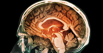 CarverJohns's tweet photo. Cannabinoids for Brain Cancer

The study's authors discussed several ways in which cannabis may help those with cancerous brain tumors, including with the common symptoms of chemotherapy-induced nausea and vomiting...

https://t.co/wOVFBxEaxh https://t.co/9XtWU1Ah2P