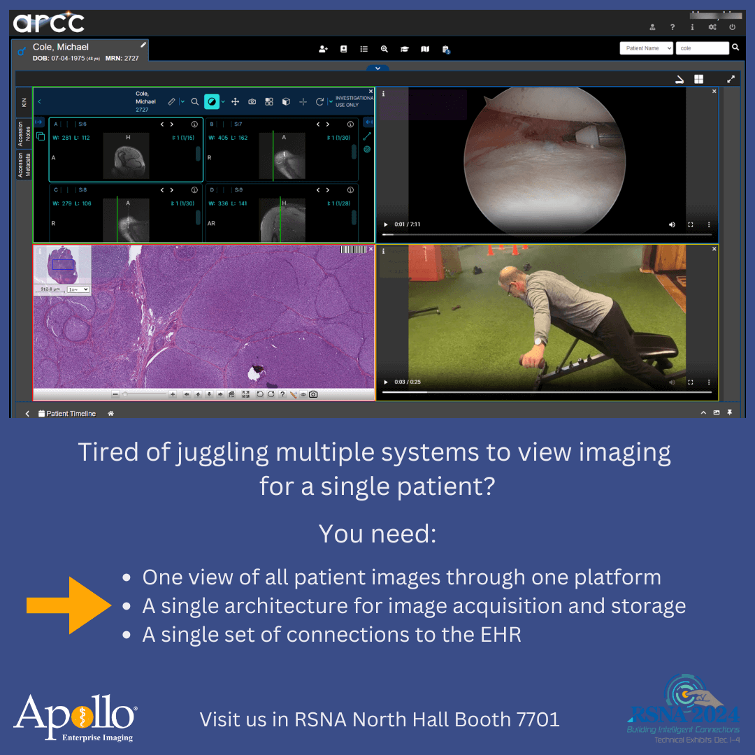 Apollo EI tweet media