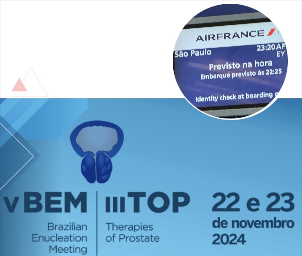 Przemysław Zugaj (@przemyslawzugaj) on Twitter photo On my way to Brazil🇧🇷
BEM 2024
Enucleation is waiting!
<a href="/ThiagoHotaUro/">Thiago Hota</a> <a href="/quanta_system/">Quanta Surgery</a> #AEEP On my way to Brazil🇧🇷
BEM 2024
Enucleation is waiting!
<a href="/ThiagoHotaUro/">Thiago Hota</a> <a href="/quanta_system/">Quanta Surgery</a> #AEEP
