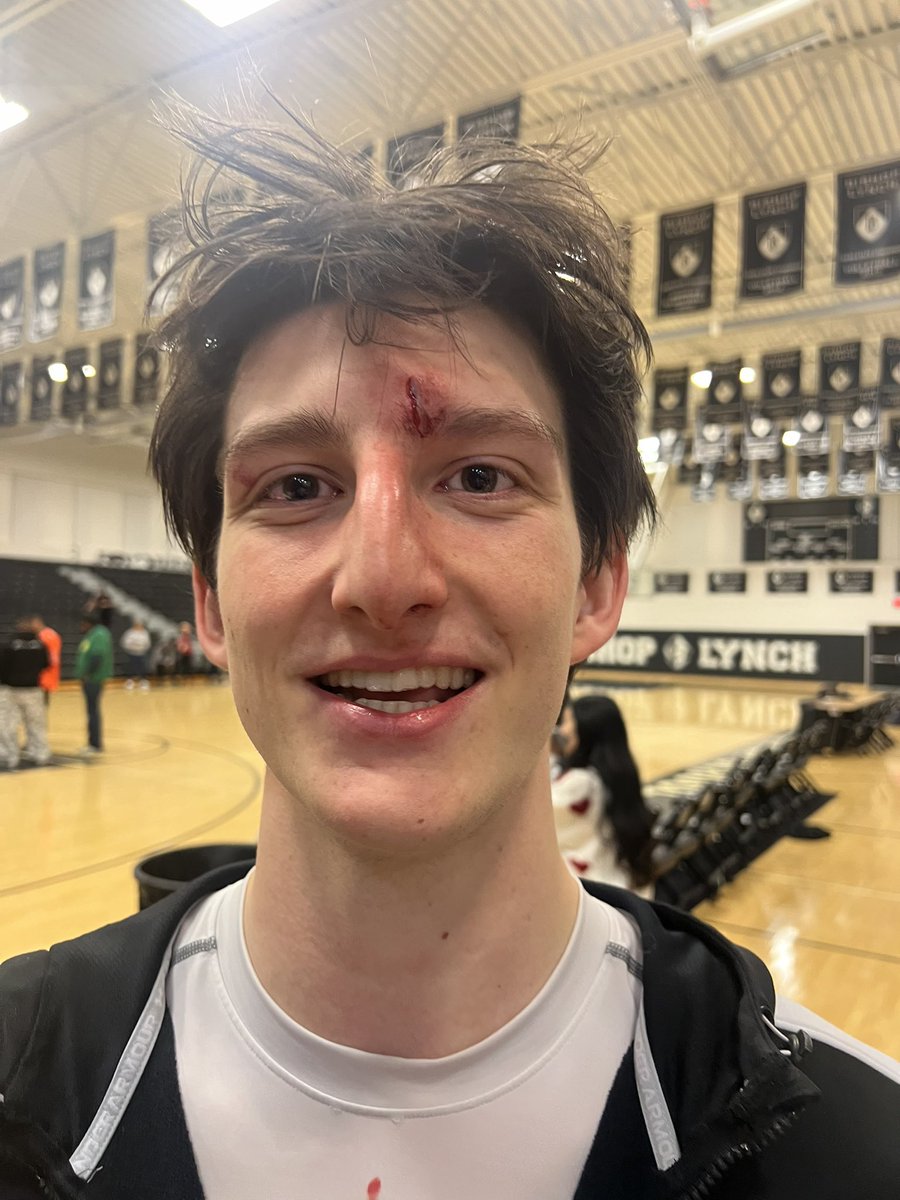 DallasRaider's tweet photo. So proud of William (and his team), stitches and all! https://t.co/Dnow50J2A6
