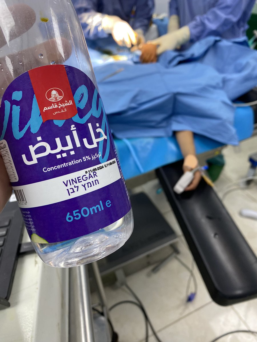 izzeddinshaheen's tweet photo. معركة شديدة تخوضها الطواقم الطبية في غرة ضد البكتيريا، التي لم تعد تستجيب لأغلب المضادات الحيوية، فبالكاد تنجو اي اصابة من التهاب الجروح مهما اجتهد الاطباء، كل الظروف سيئة لا تعقيم ولا مضادات حيوية كافية، حتى أصبحنا نجد بكتيريا ال E. Coli في أنسجة العظم وهذا غير مألوف في كتب الطب https://t.co/cDc1PUUqtJ